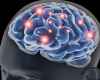 brain.jpg